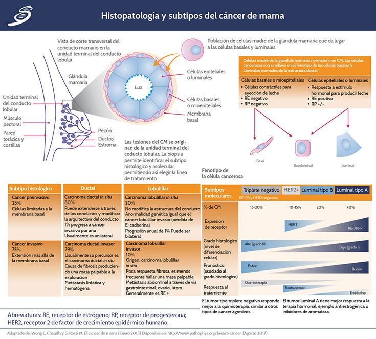 diagrama de examen clínico de mama