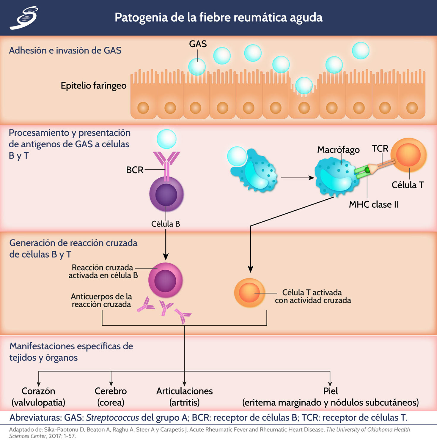 imágenes de faringitis estreptocócica en adultos